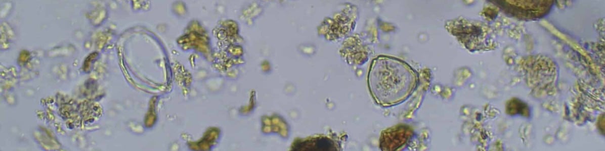 sol_microorganismes_the_de_compost_permaculture